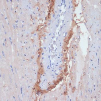 COL1A1 / Collagen I Alpha 1 Antibody - Immunohistochemistry of paraffin-embedded Rat heart using COL1A1 Polyclonal Antibody at dilution of 1:200 (40x lens).