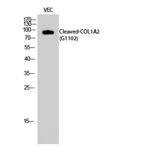 COL1A2 / Collagen I Alpha 2 Antibody - Western blot of Cleaved-COL1A2 (G1102) antibody