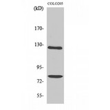 COL1A2 / Collagen I Alpha 2 Antibody - Western blot of COL1A2 antibody