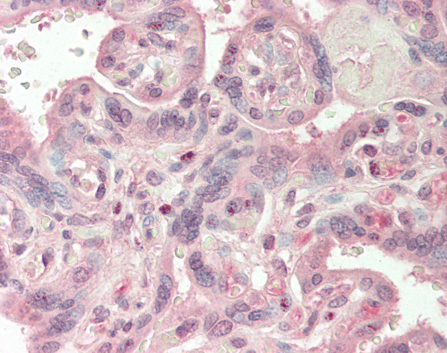 COL1A2 / Collagen I Alpha 2 Antibody - Human Placenta: Formalin-Fixed, Paraffin-Embedded (FFPE).  This image was taken for the unconjugated form of this product. Other forms have not been tested.