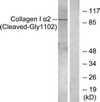 COL1A2 / Collagen I Alpha 2 Antibody - Western blot of extracts from Jurkat cells, treated with etoposide 25 uM 24h, using Collagen I alpha2 (Cleaved-Gly1102) Antibody. The lane on the right is treated with the synthesized peptide.