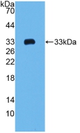 COL1A2 / Collagen I Alpha 2 Antibody