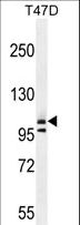 COL1A2 / Collagen I Alpha 2 Antibody - COL1A2 Antibody western blot of T47D cell line lysates (35 ug/lane). The COL1A2 antibody detected the COL1A2 protein (arrow).