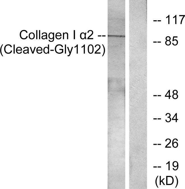 COL1A2 / Collagen I Alpha 2 Antibody - Western blot analysis of extracts from Jurkat cells, treated with etoposide (25uM, 24hours), using Collagen I a2 (Cleaved-Gly1102) antibody.