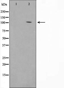 COL1A2 / Collagen I Alpha 2 Antibody - Western blot analysis of Collagen I antibody expression in mouse skin tissue lysates. The lane on the left is treated with the antigen-specific peptide.