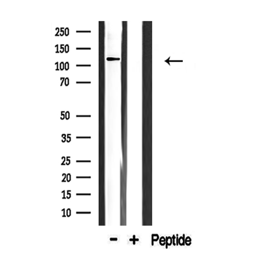 COL1A2 / Collagen I Alpha 2 Antibody - Western blot analysis of extracts of mouse muscle using Collagen I a2 antibody.