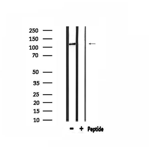 COL1A2 / Collagen I Alpha 2 Antibody - Western blot analysis of extracts of HepG2 cells using Collagen I a2 antibody.