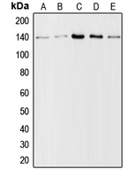 COL1A2 / Collagen I Alpha 2 Antibody - Western blot analysis of Collagen 1 alpha 2 expression in A10 (A); HeLa (B); mouse lung (C); mouse liver (D); rat liver (E) whole cell lysates.