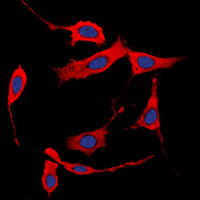COL1A2 / Collagen I Alpha 2 Antibody - Immunofluorescent analysis of Collagen 1 alpha 2 staining in HeLa cells. Formalin-fixed cells were permeabilized with 0.1% Triton X-100 in TBS for 5-10 minutes and blocked with 3% BSA-PBS for 30 minutes at room temperature. Cells were probed with the primary antibody in 3% BSA-PBS and incubated overnight at 4 C in a humidified chamber. Cells were washed with PBST and incubated with a DyLight 594-conjugated secondary antibody (red) in PBS at room temperature in the dark. DAPI was used to stain the cell nuclei (blue).