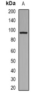 COL1A2 / Collagen I Alpha 2 Antibody - Western blot analysis of Collagen 1 alpha 2 expression in Jurkat (A) whole cell lysates.