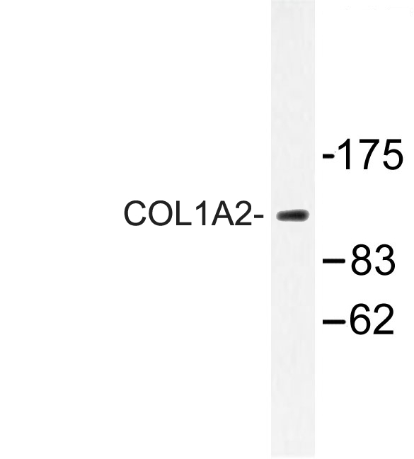COL1A2 / Collagen I Alpha 2 Antibody - Western blot of COL1A2 (T501) pAb in extracts from 293 cells.