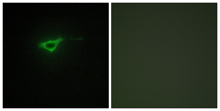 COL20A1 / Collagen XX Antibody - Immunofluorescence analysis of NIH/3T3 cells, using Collagen XX alpha1 Antibody. The picture on the right is blocked with the synthesized peptide.