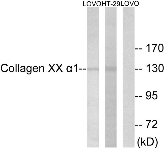 COL20A1 / Collagen XX Antibody - Western blot analysis of lysates from LOVO and HT-19 cells, using Collagen XX alpha1 Antibody. The lane on the right is blocked with the synthesized peptide.