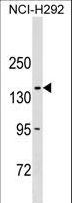 COL20A1 / Collagen XX Antibody - COL20A1 Antibody western blot of NCI-H292 cell line lysates (35 ug/lane). The COL20A1 antibody detected the COL20A1 protein (arrow).