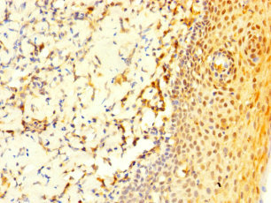 COL20A1 / Collagen XX Antibody - Immunohistochemistry of paraffin-embedded human tonsil tissue using COL20A1 Antibody at dilution of 1:100