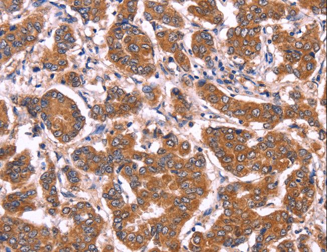 COL20A1 / Collagen XX Antibody - Immunohistochemistry of paraffin-embedded Human tonsil using COL20A1 Polyclonal Antibody at dilution of 1:40.