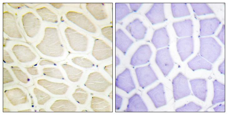 COL20A1 / Collagen XX Antibody - Peptide - + Immunohistochemistry analysis of paraffin-embedded human skeletal muscle tissue using Collagen XX a1 antibody.