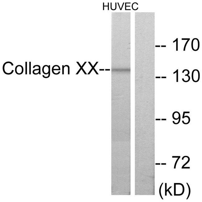 COL20A1 / Collagen XX Antibody - Western blot analysis of extracts from HUVEC cells, using Collagen XX a1 antibody.