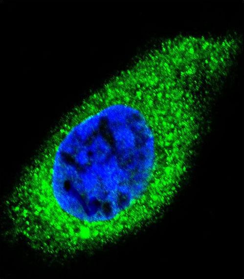 COL21A1 / Collagen XXI Antibody - Confocal immunofluorescence of COL21A1 Antibody with HepG2 cell followed by Alexa Fluor 488-conjugated goat anti-rabbit lgG (green). DAPI was used to stain the cell nuclear (blue).