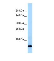 COL21A1 / Collagen XXI Antibody - Western blot of Human Fetal Liver. COL21A1 antibody dilution 1.0 ug/ml.  This image was taken for the unconjugated form of this product. Other forms have not been tested.