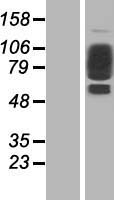COL21A1 / Collagen XXI Protein - Western validation with an anti-DDK antibody * L: Control HEK293 lysate R: Over-expression lysate
