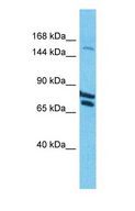 COL22A1 / Collagen XXII Antibody - Western blot of COL22A1 Antibody with human HT1080 Whole Cell lysate.  This image was taken for the unconjugated form of this product. Other forms have not been tested.