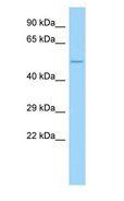 COL23A1 / Collagen XXIII Antibody - COL23A1 / Collagen XXIII antibody Western Blot of Fetal Liver.  This image was taken for the unconjugated form of this product. Other forms have not been tested.
