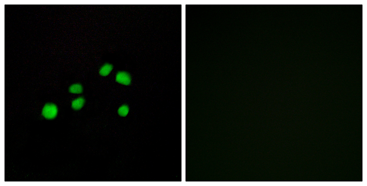 COL23A1 / Collagen XXIII Antibody - Immunofluorescence analysis of HepG2 cells, using Collagen XXIII alpha1 Antibody. The picture on the right is blocked with the synthesized peptide.