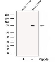 COL23A1 / Collagen XXIII Antibody - Western blot analysis of extracts of A2780 cells using Collagen Type XXIII antibody. The lane on the left was treated with blocking peptide.