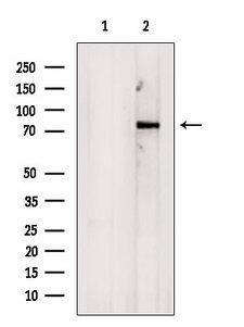 COL23A1 / Collagen XXIII Antibody