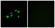 COL23A1 / Collagen XXIII Antibody - Peptide - + Immunofluorescence analysis of HepG2 cells, using Collagen XXIII a1 antibody.