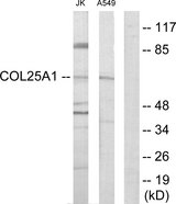 COL25A1 / Collagen XXV Antibody - Western blot analysis of lysates from Jurkat and A549 cells, using Collagen XXV alpha1 Antibody. The lane on the right is blocked with the synthesized peptide.