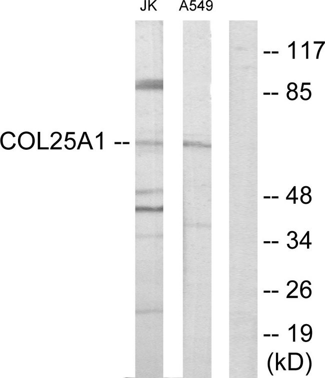 COL25A1 / Collagen XXV Antibody - Western blot analysis of lysates from Jurkat and A549 cells, using Collagen XXV alpha1 Antibody. The lane on the right is blocked with the synthesized peptide.
