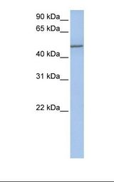 COL25A1 / Collagen XXV Antibody - Jurkat cell lysate. Antibody concentration: 1.0 ug/ml. Gel concentration: 12%.  This image was taken for the unconjugated form of this product. Other forms have not been tested.
