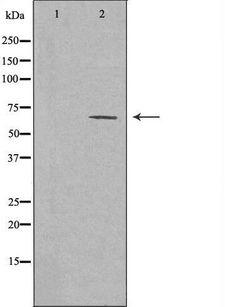 COL25A1 / Collagen XXV Antibody - Western blot analysis of extracts of Jurkat cells using Collagen XXV antibody. The lane on the left is treated with the antigen-specific peptide.