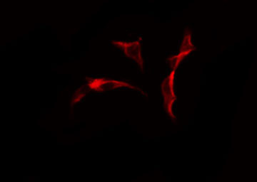 COL25A1 / Collagen XXV Antibody - Staining HeLa cells by IF/ICC. The samples were fixed with PFA and permeabilized in 0.1% Triton X-100, then blocked in 10% serum for 45 min at 25°C. The primary antibody was diluted at 1:200 and incubated with the sample for 1 hour at 37°C. An Alexa Fluor 594 conjugated goat anti-rabbit IgG (H+L) antibody, diluted at 1/600, was used as secondary antibody.