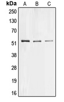 COL26A1 / EMID2 Antibody - Western blot analysis of Collagen 26 alpha 1 expression in HeLa (A); PC12 (B); H9C2 (C) whole cell lysates.