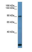 COL27A1 Antibody - COL27A1 antibody Western Blot of Fetal Lung. Antibody dilution: 1 ug/ml.  This image was taken for the unconjugated form of this product. Other forms have not been tested.