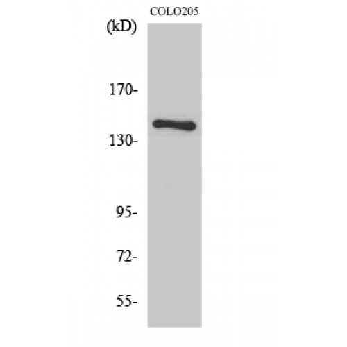 COL2A1 / Collagen II Alpha 1 Antibody - Western blot of COL2A1 antibody