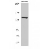 COL2A1 / Collagen II Alpha 1 Antibody - Western blot of COL2A1 antibody