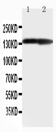 COL2A1 / Collagen II Alpha 1 Antibody - Collagen II antibody Western blot. Lane 1: Rat Heart Tissue Lysate. Lane 1: Rat Brain Tissue Lysate.