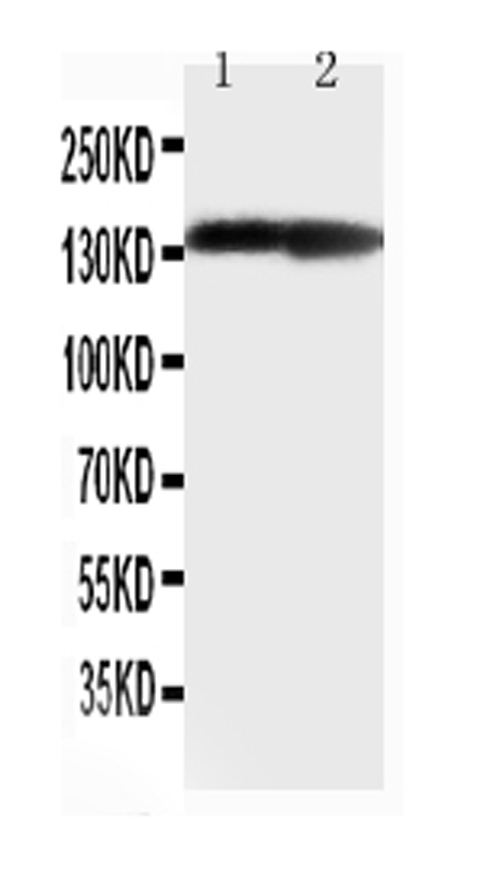 COL2A1 / Collagen II Alpha 1 Antibody - Anti-Collagen II antibody, Western blotting Lane 1: Rat Heart Tissue LysateLane 1: Rat Brain Tissue Lysate