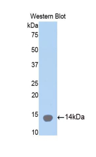 COL2A1 / Collagen II Alpha 1 Antibody - Western blot of COL2A1 / Collagen II Alpha 1 antibody.
