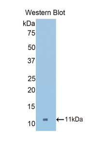 COL2A1 / Collagen II Alpha 1 Antibody - Western blot of COL2A1 / Collagen II Alpha 1 antibody.