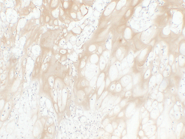 COL2A1 / Collagen II Alpha 1 Antibody - Chondrosarcoma