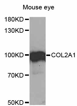 COL2A1 / Collagen II Alpha 1 Antibody - Western blot analysis of extracts of mouse eye, using COL2A1 antibody at 1:1000 dilution. The secondary antibody used was an HRP Goat Anti-Rabbit IgG (H+L) at 1:10000 dilution. Lysates were loaded 25ug per lane and 3% nonfat dry milk in TBST was used for blocking. An ECL Kit was used for detection and the exposure time was 30s.