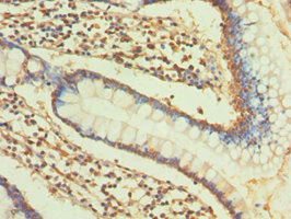 COL2A1 / Collagen II Alpha 1 Antibody - Immunohistochemistry of paraffin-embedded small intestine at dilution 1:100