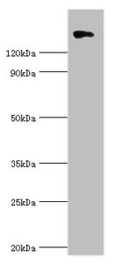 COL2A1 / Collagen II Alpha 1 Antibody - Western blot All lanes: Collagen alpha-1 (II) chain antibody at 10µg/ml + 293T whole cell lysate Secondary Goat polyclonal to rabbit IgG at 1/10000 dilution Predicted band size: 142, 135, 30 kDa Observed band size: 142 kDa