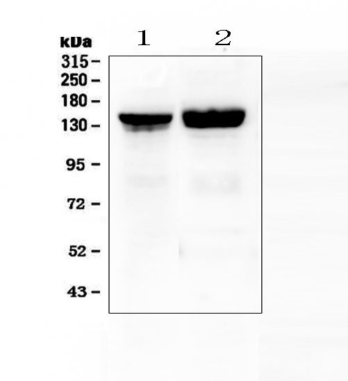 COL2A1 / Collagen II Alpha 1 Antibody - Western blot analysis of Collagen II using anti-Collagen II antibody. Electrophoresis was performed on a 5-20% SDS-PAGE gel at 70V (Stacking gel) / 90V (Resolving gel) for 2-3 hours. The sample well of each lane was loaded with 50ug of sample under reducing conditions. Lane 1: rat liver tissue lysates, Lane 2: mouse liver tissue lysates. After Electrophoresis, proteins were transferred to a Nitrocellulose membrane at 150mA for 50-90 minutes. Blocked the membrane with 5% Non-fat Milk/ TBS for 1.5 hour at RT. The membrane was incubated with rabbit anti-Collagen II antigen affinity purified polyclonal antibody at 0.5 ?g/mL overnight at 4?C, then washed with TBS-0.1% Tween 3 times with 5 minutes each and probed with a goat anti-rabbit IgG-HRP secondary antibody at a dilution of 1:10000 for 1.5 hour at RT. The signal is developed using an Enhanced Chemiluminescent detection (ECL) kit with Tanon 5200 system. A specific band was detected for Collagen II at approximately 142KD. The expected band size for Collagen II is at 142KD.