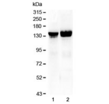 COL2A1 / Collagen II Alpha 1 Antibody - Western blot testing of 1) rat liver and 2) mouse liver lysate with Collagen II antibody at 0.5ug/ml. Predicted molecular weight ~140 kDa.